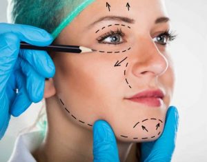 medical spa rx Facelifts Make a Comeback in 2016