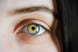 medical spa rx Radiesse For Under Eyes Explained