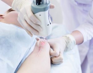 medical spa rx Treating Scars