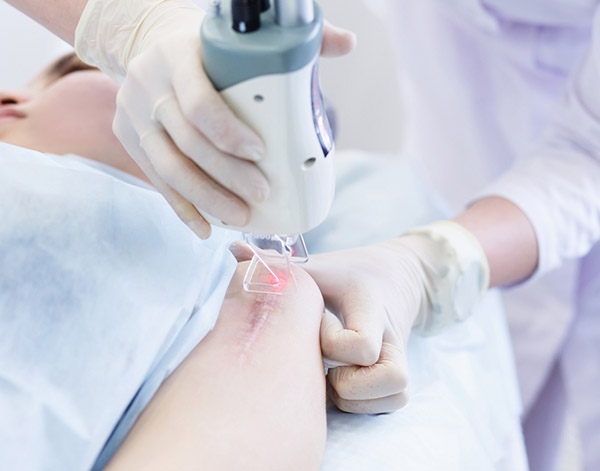 medical spa rx Treating Scars