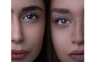 medical spa rx Juvederm For Nose: Procedure