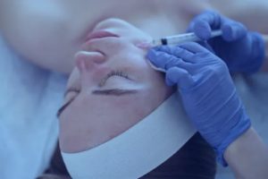 medical spa rx Treating Permanent Dermal Filler Complications Explained